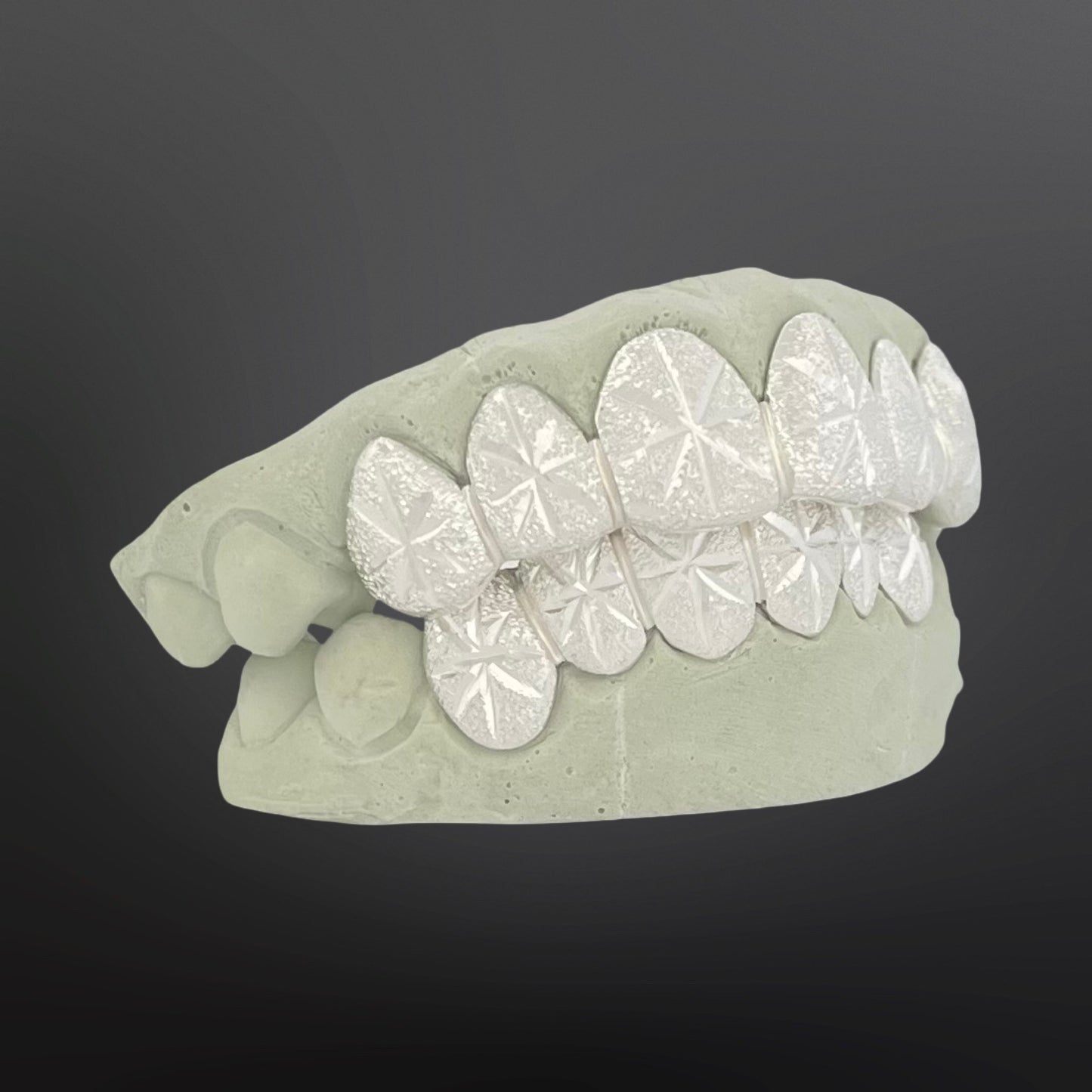 Dental model with white teeth on a dark background