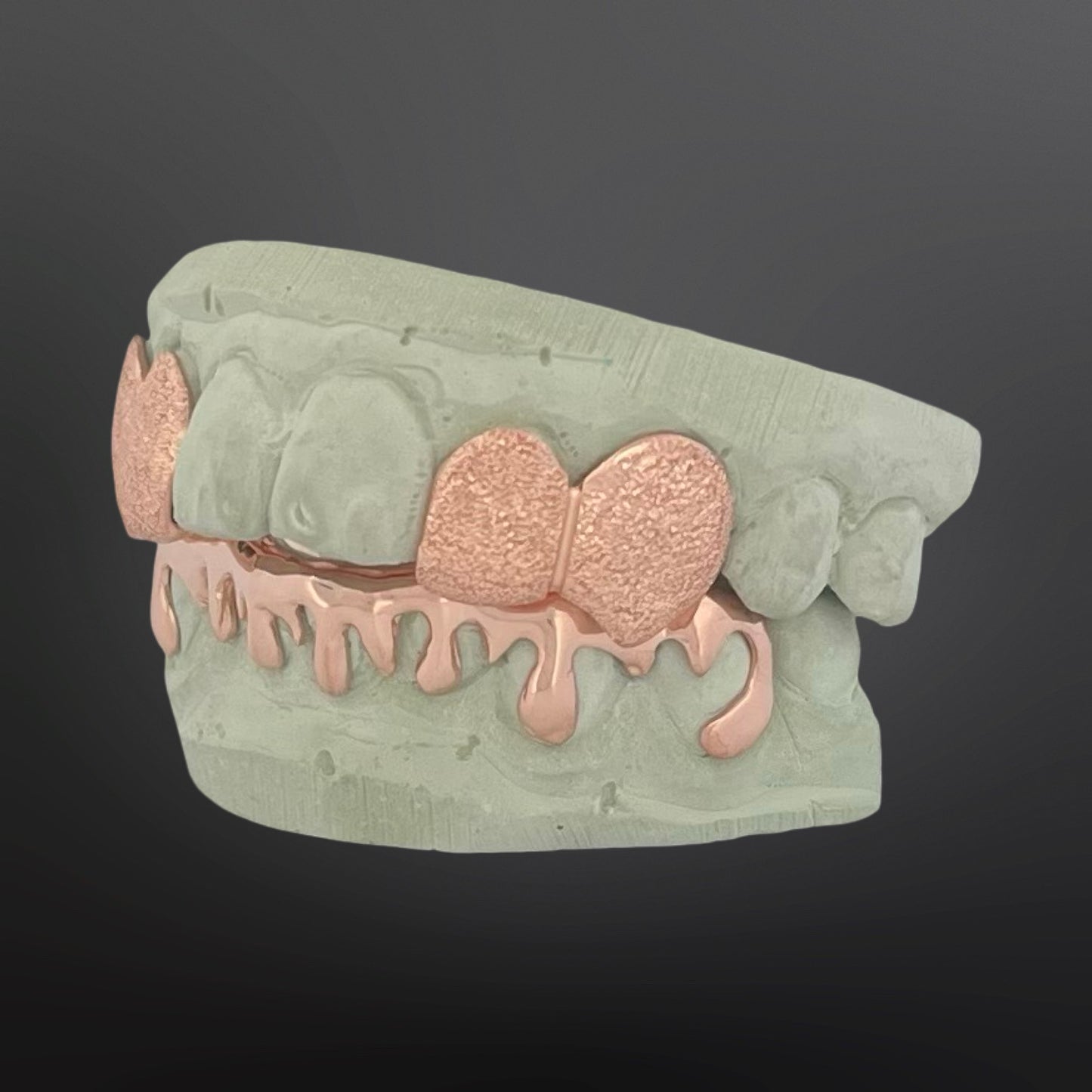 Mold of a mouth with rose gold accents on a dark background