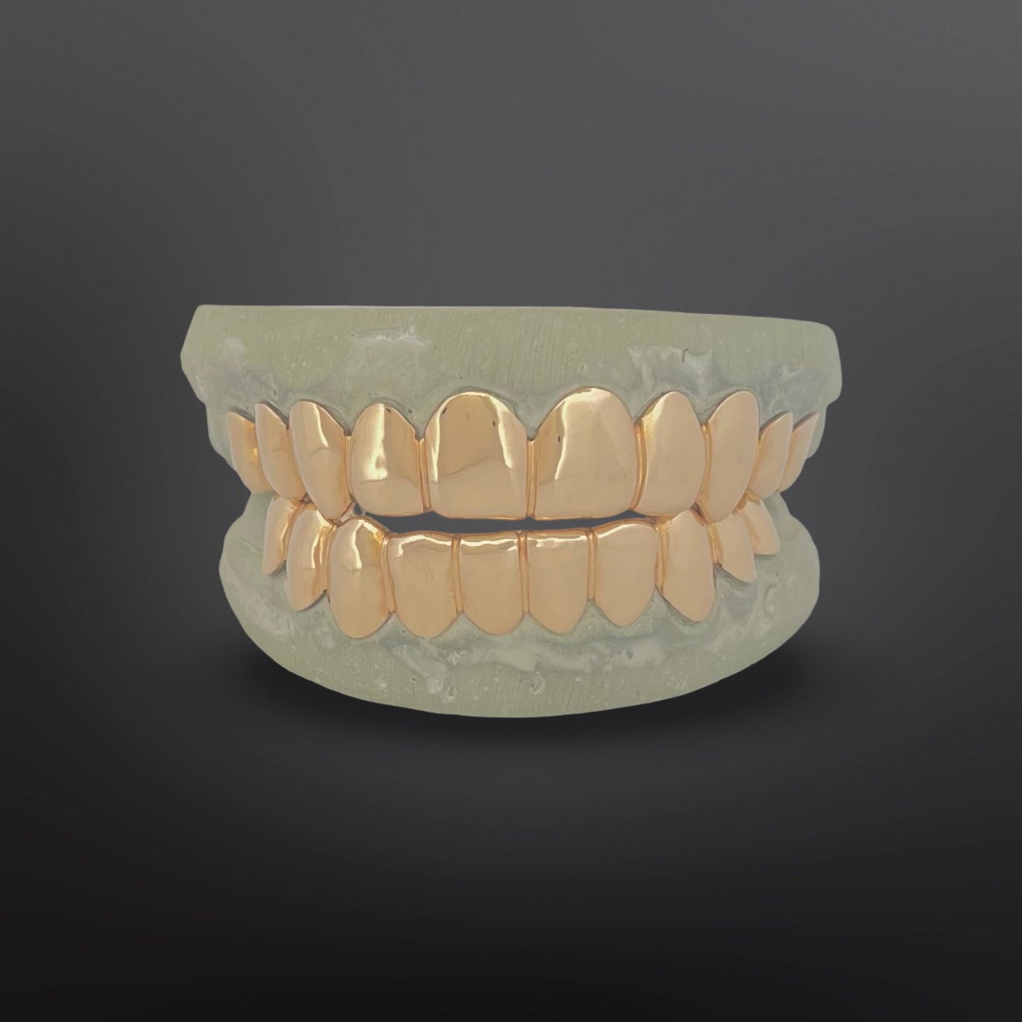 Custom solid 10K gold grillz top and bottom full mouth set on dental mold