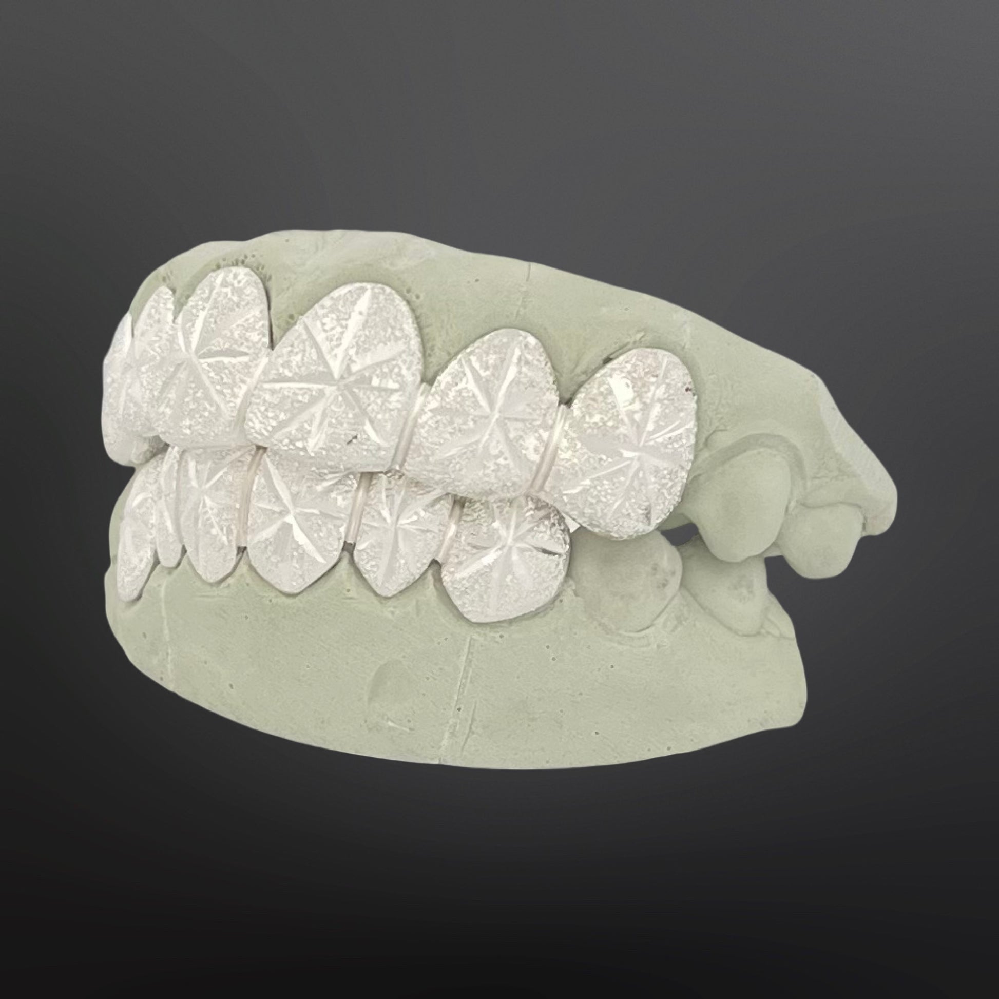 Dental model with diamond-studded grill on a dark background