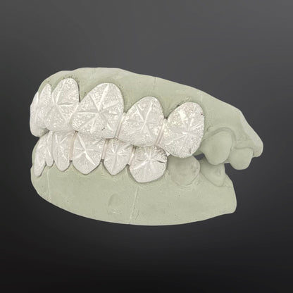 Dental model with diamond-studded grill on a dark background