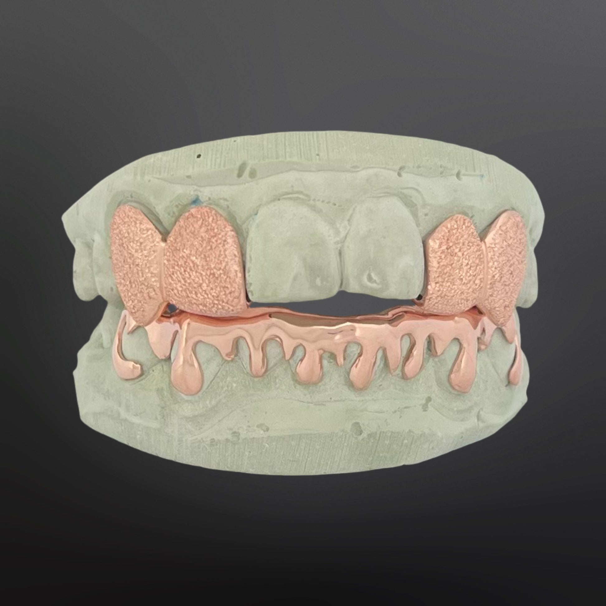 Teeth-shaped grill with rose gold accents on a dark background