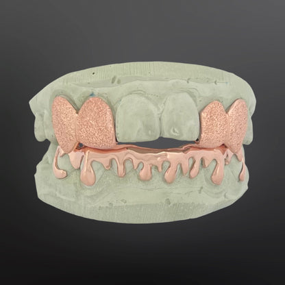 Teeth-shaped grill with rose gold accents on a dark background