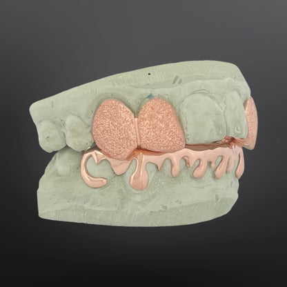 Dental model with rose gold teeth on a dark background