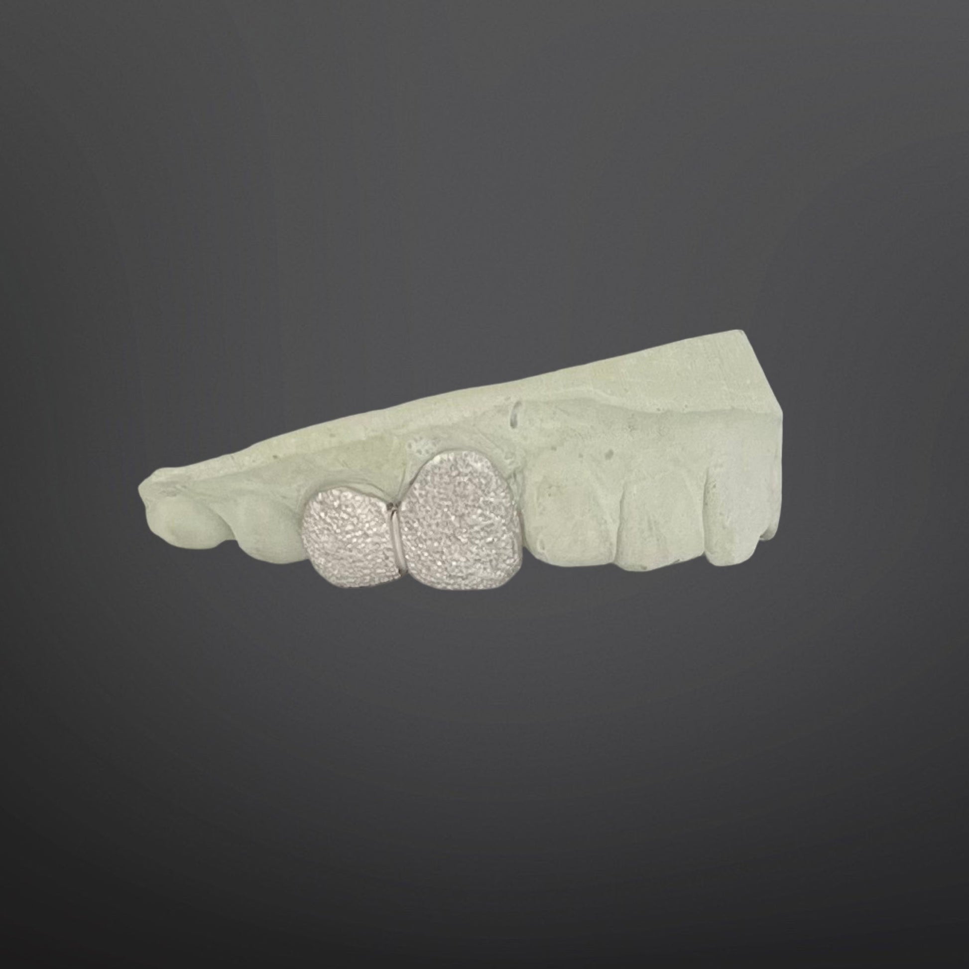 Dental model with diamond-studded teeth on a dark background