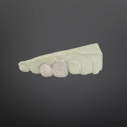 Dental model with diamond-studded teeth on a dark background