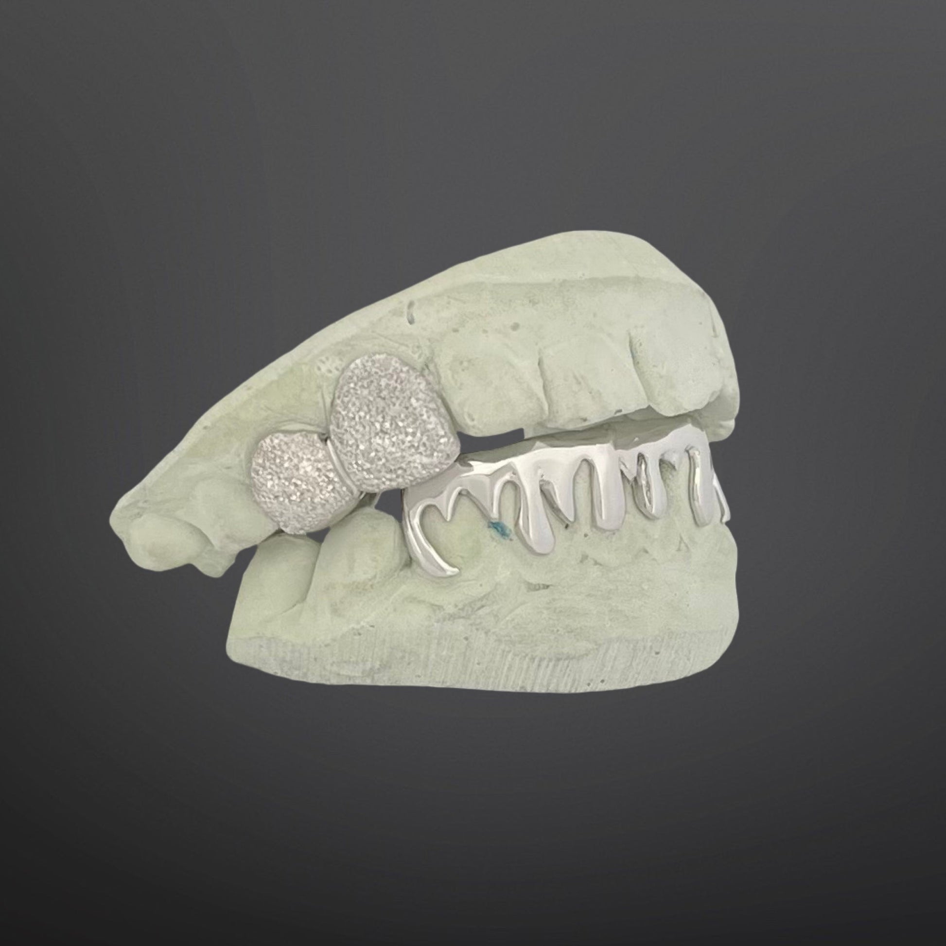 Dental model with teeth and a ring on a dark background