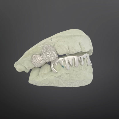 Dental model with teeth and a ring on a dark background