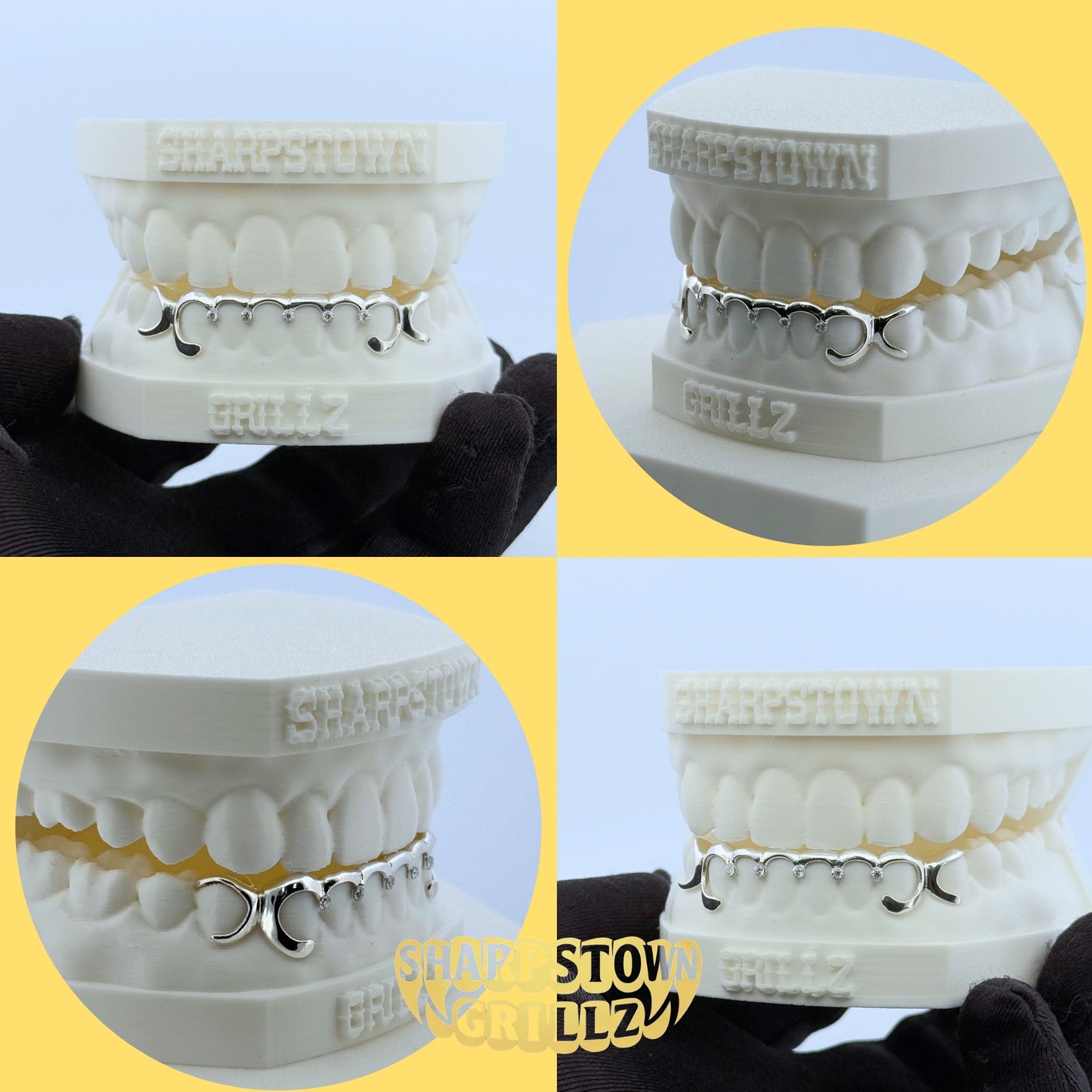 Custom 10K Gold diamond cut top teeth caps with diamond dust textured faces.