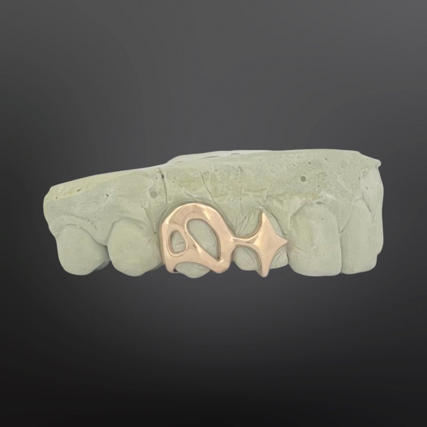 Dental model with gold dental appliance on a dark background