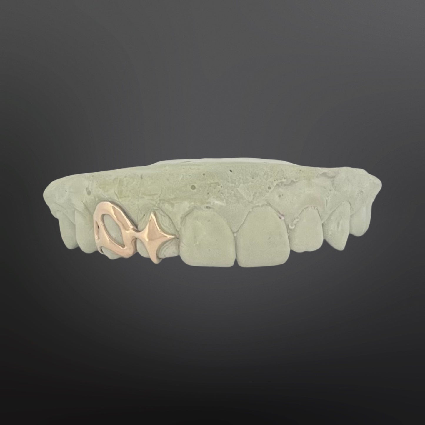 Teeth-shaped grill with gold fish charm on a dark background