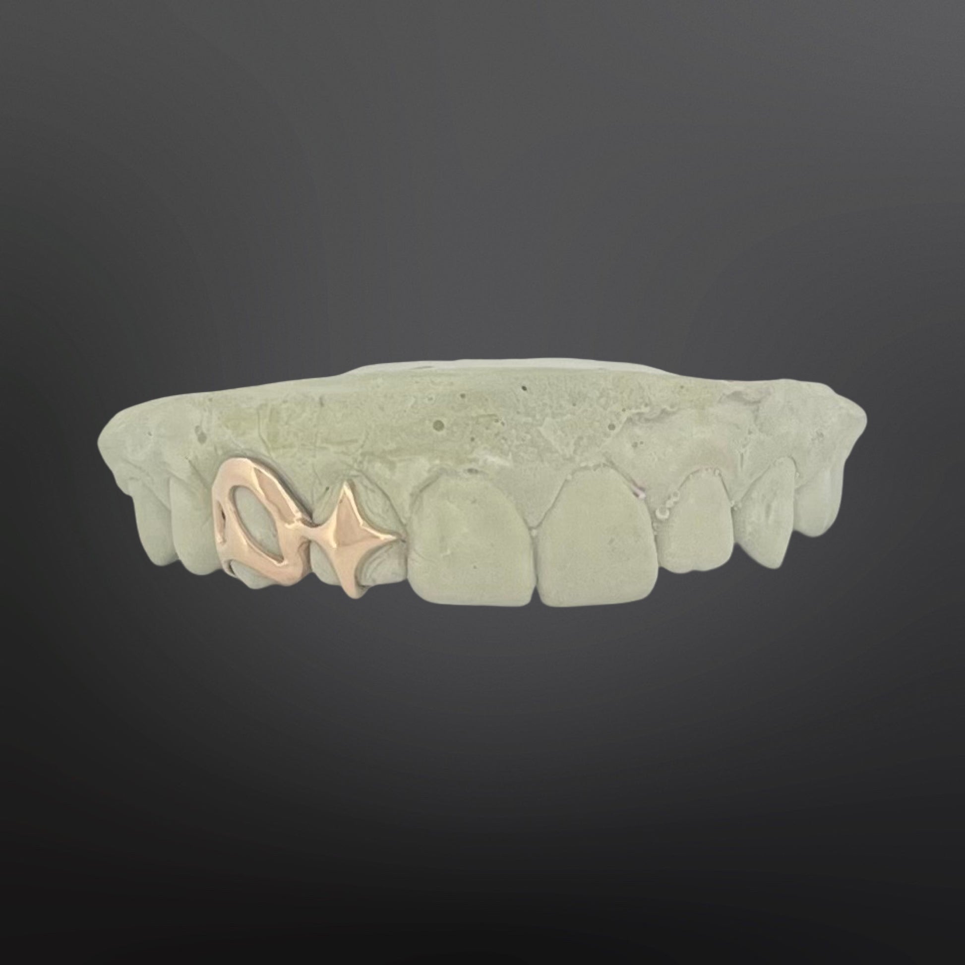 Teeth-shaped grill with gold fish charm on a dark background