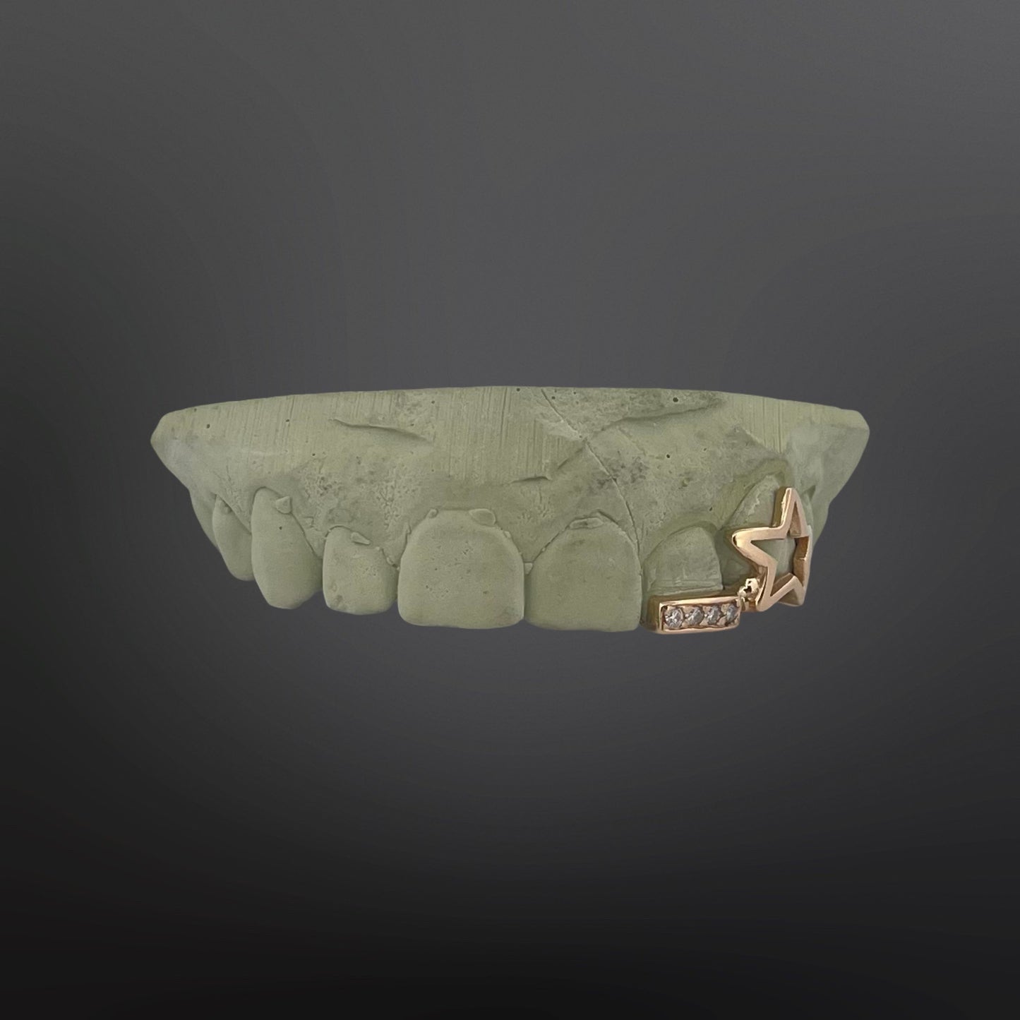 Star Shaped Tooth And Iced Out Bar Tip Cover Two Teeth Top Set Natural Gold