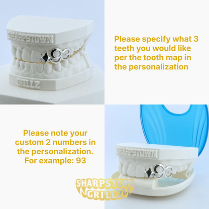 Custom 2003 date open face teeth grillz featuring red and yellow oval enamel inlay fills.