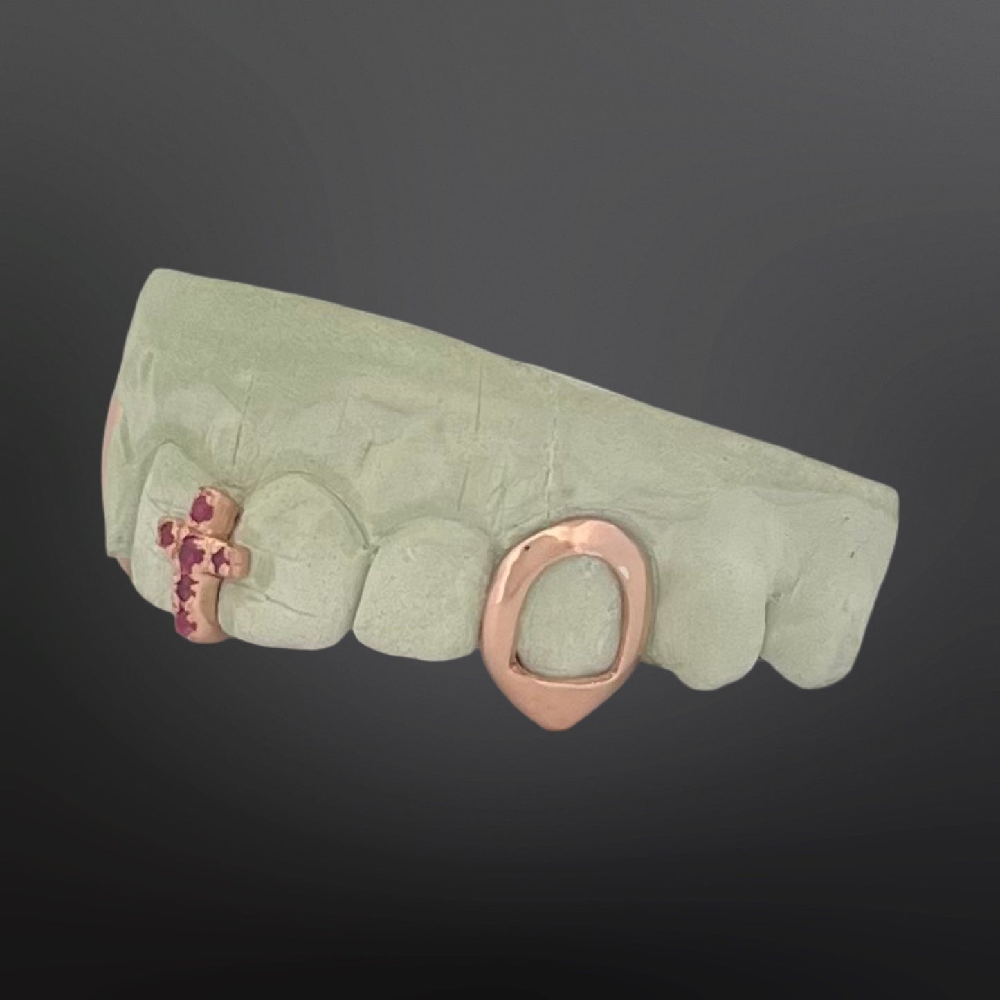 Green false teeth with a rose gold ring and red gemstones on a dark background