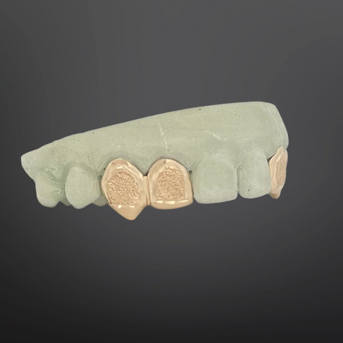 Teeth-shaped grill with gold accents on a dark background