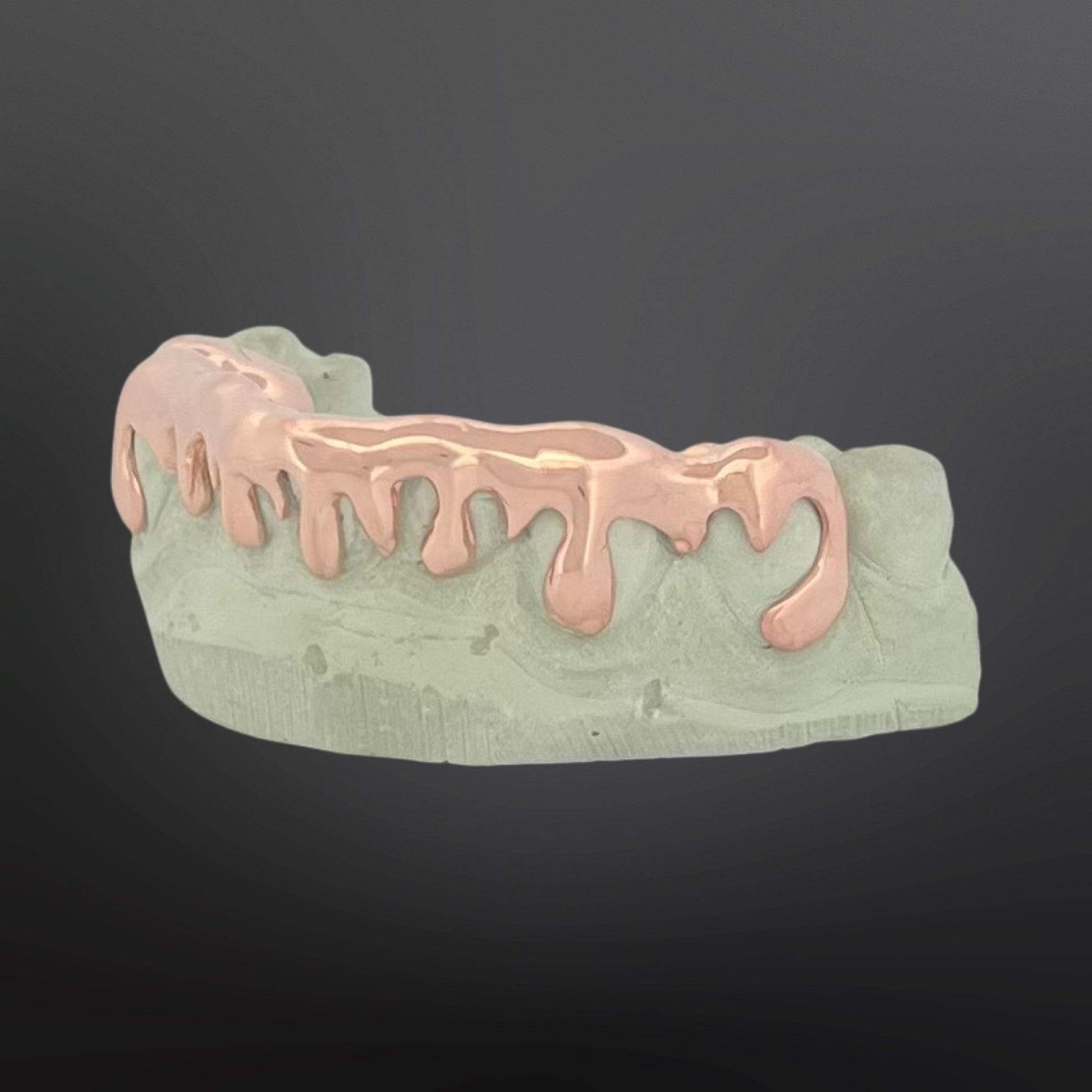 Dental model with rose gold metallic finish on a dark background