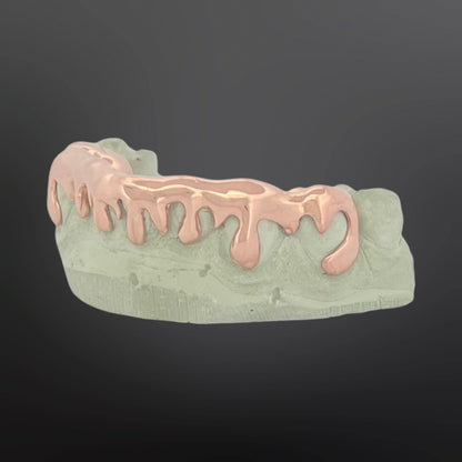 Dental model with rose gold metallic finish on a dark background
