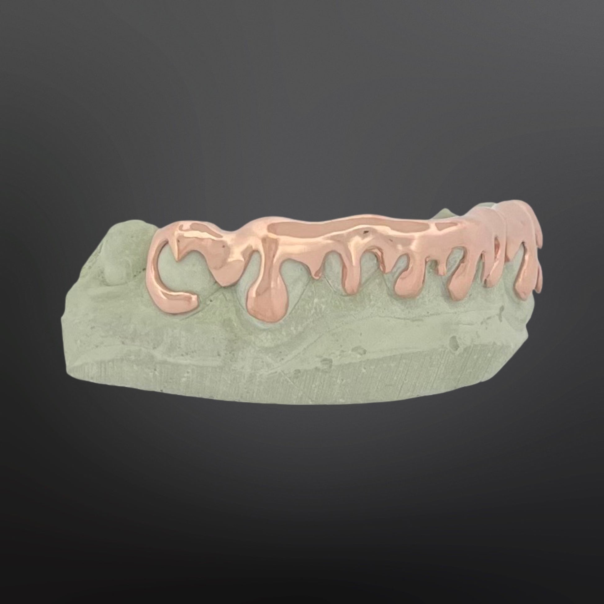 Dental model with rose gold grill on a dark background