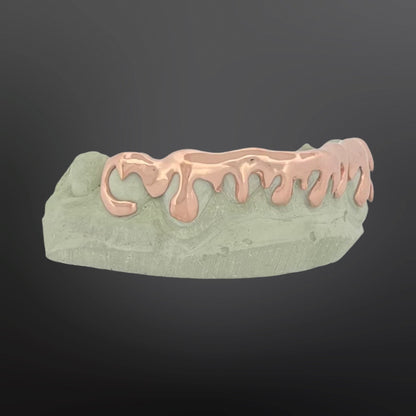 Dental model with rose gold grill on a dark background