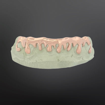 Dental model with pink and green materials on a dark background