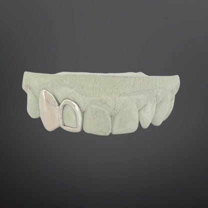 Open face window grillz set paired with polished solid gold fangs