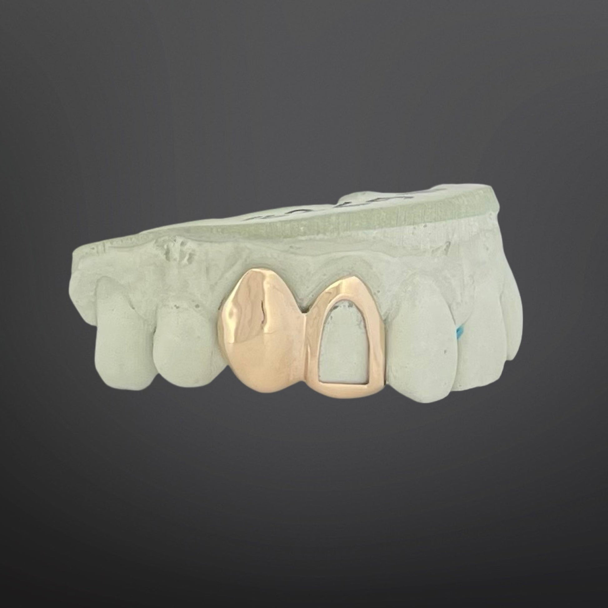 Custom 2 cap gold grillz with solid tooth and open frame window