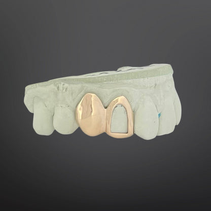 Custom 2 cap gold grillz with solid tooth and open frame window