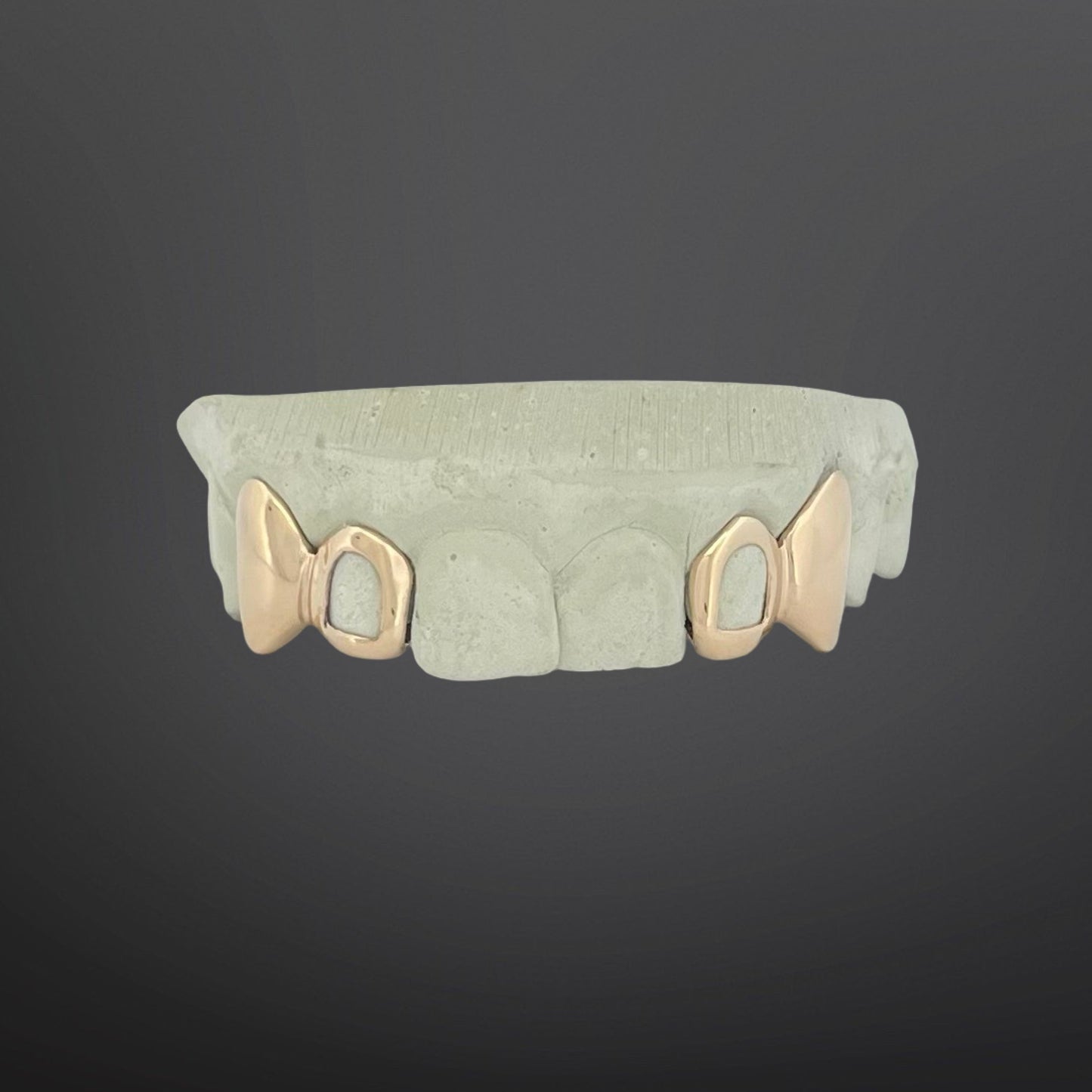 Custom 4 cap gold grillz with solid fangs and open window cutouts