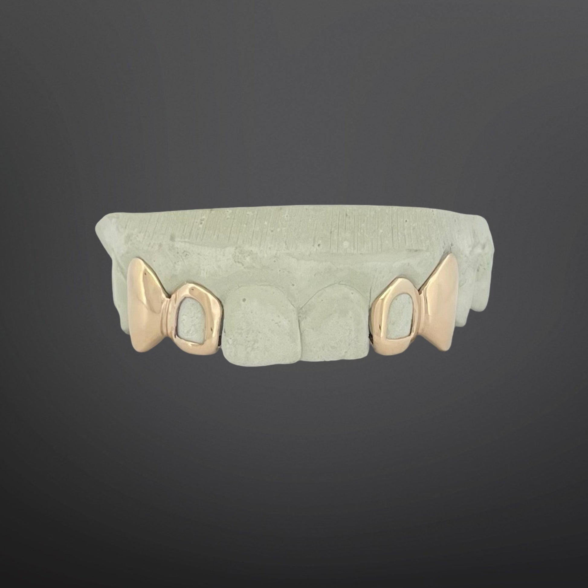 Custom 4 cap gold grillz with solid fangs and open window cutouts