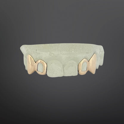 Custom 4 cap gold grillz with solid fangs and open window cutouts