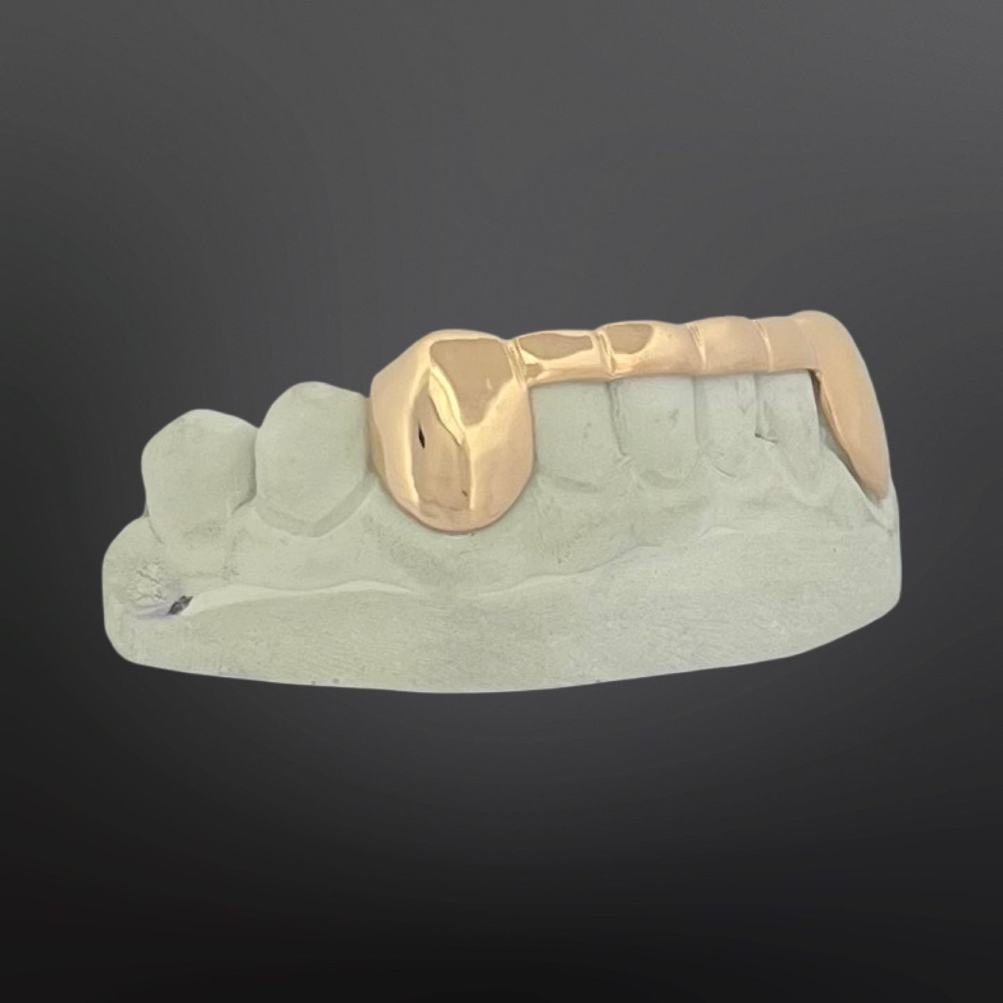 Gold dental model on a gray background