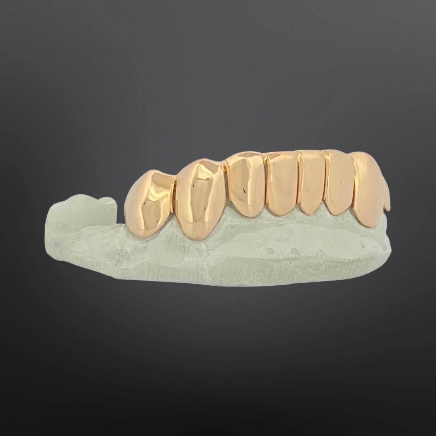 Gold dental model on a gray background