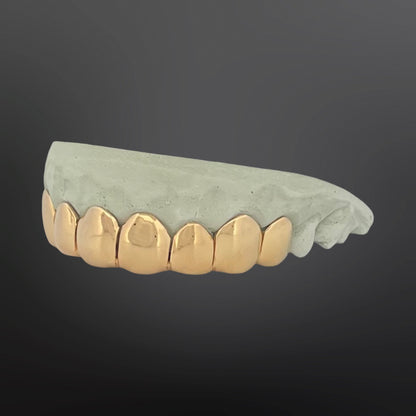 Gold dental grill on a dark gray background