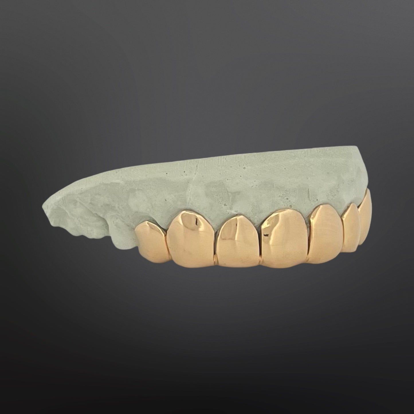 Gold dental grill on a dark gray background