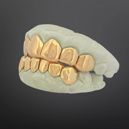 Gold grill on a gray skull against a black background