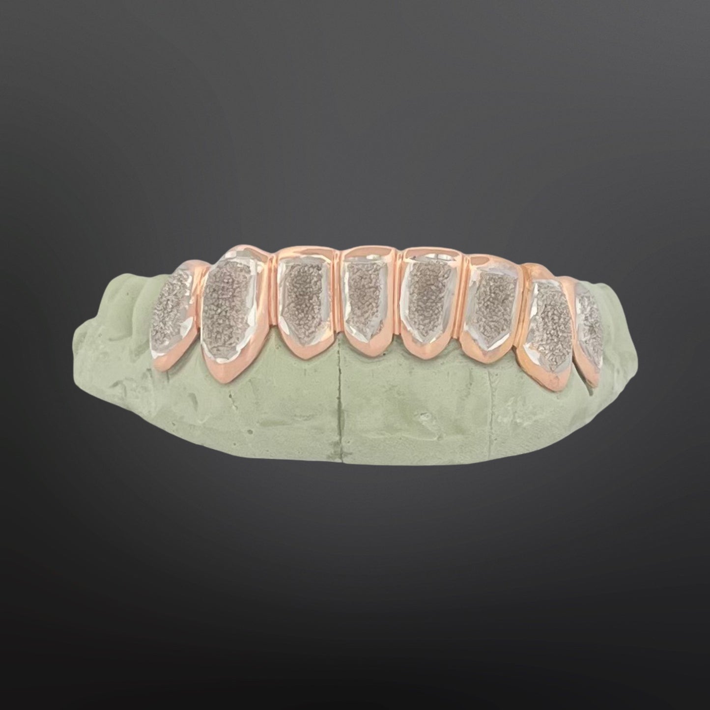 Dental model with metallic crowns on a dark background