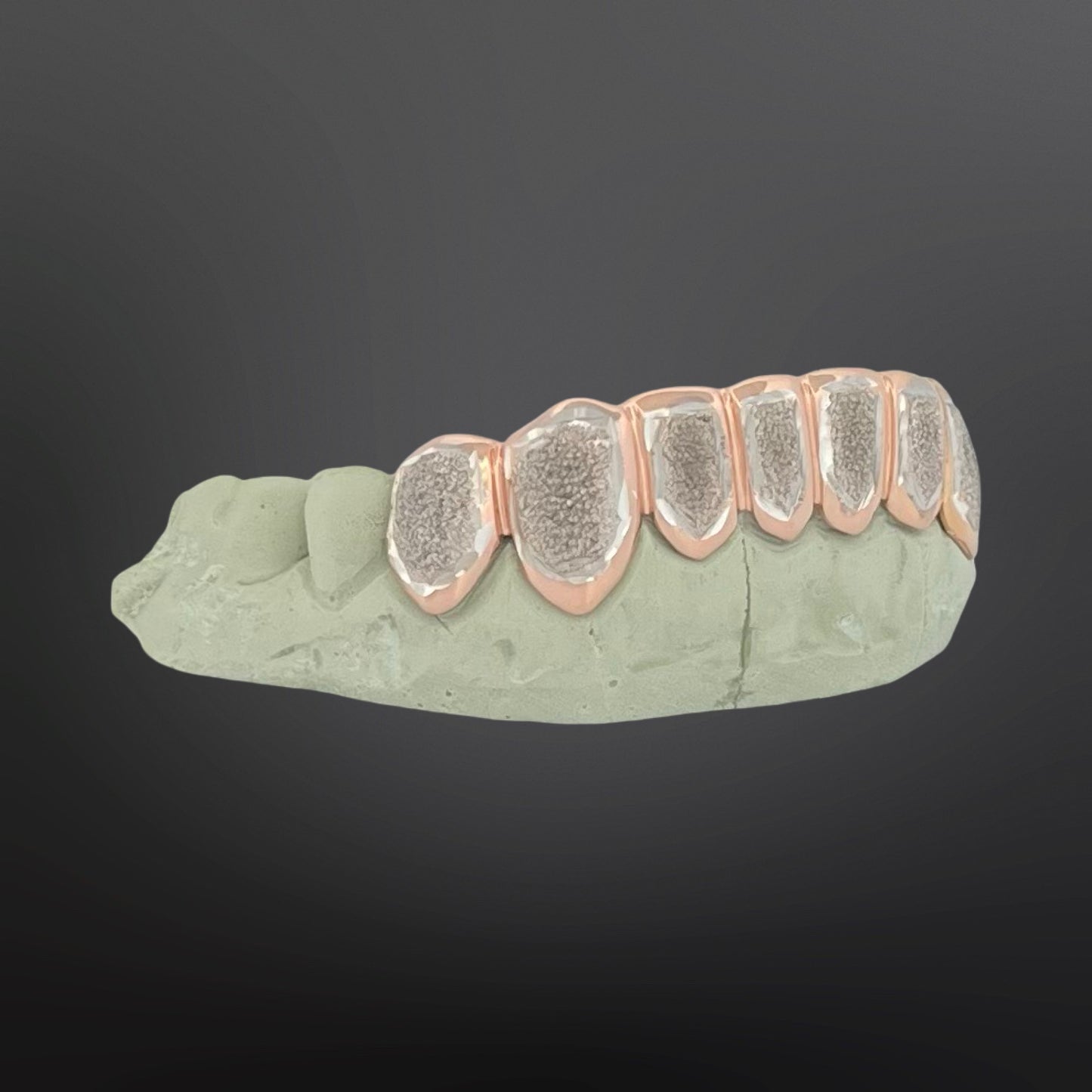 Dental model with metallic crowns on a dark background