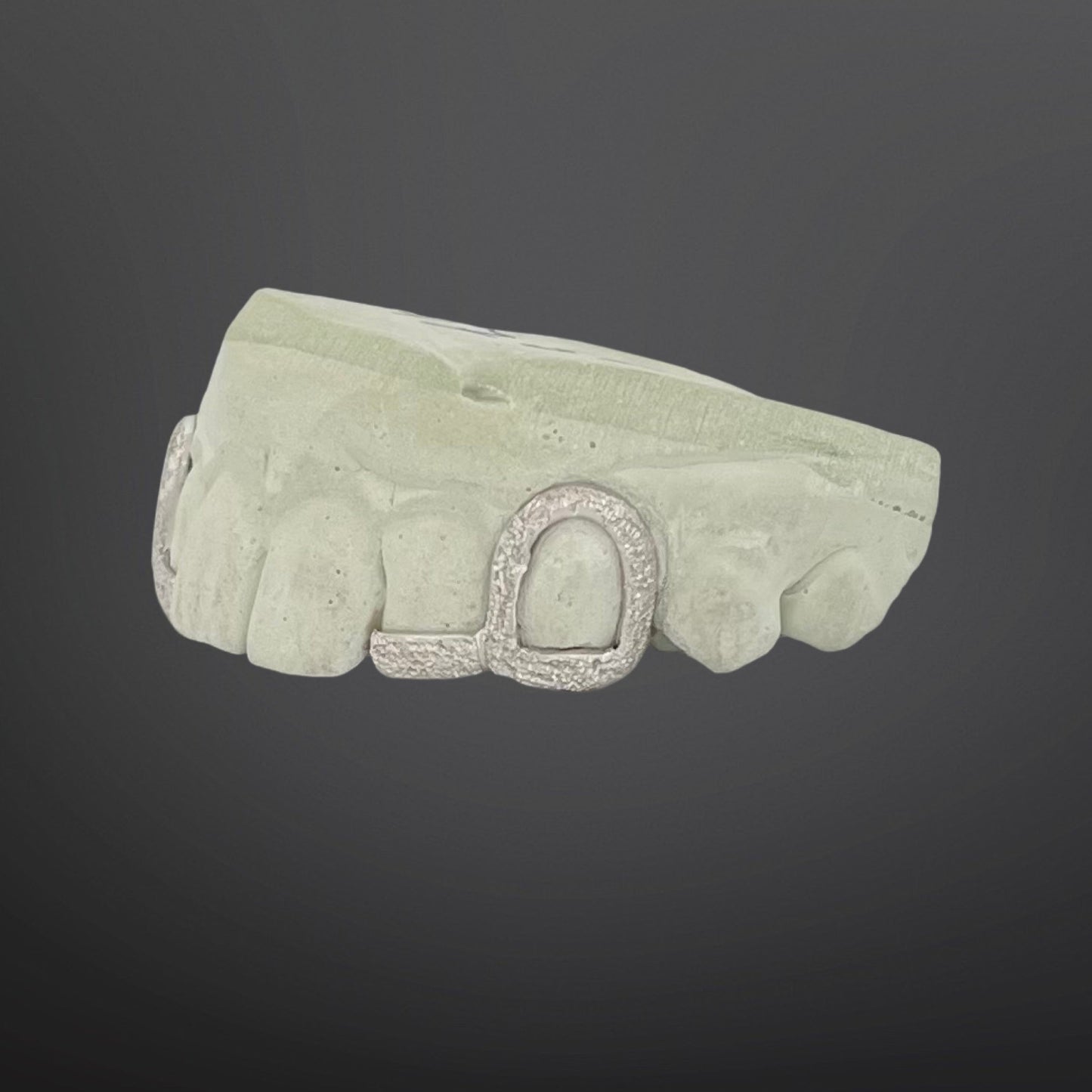 Diamond Dust Open Face And Tip Cover Two By Two Top Set With Back Bar Sterling Silver