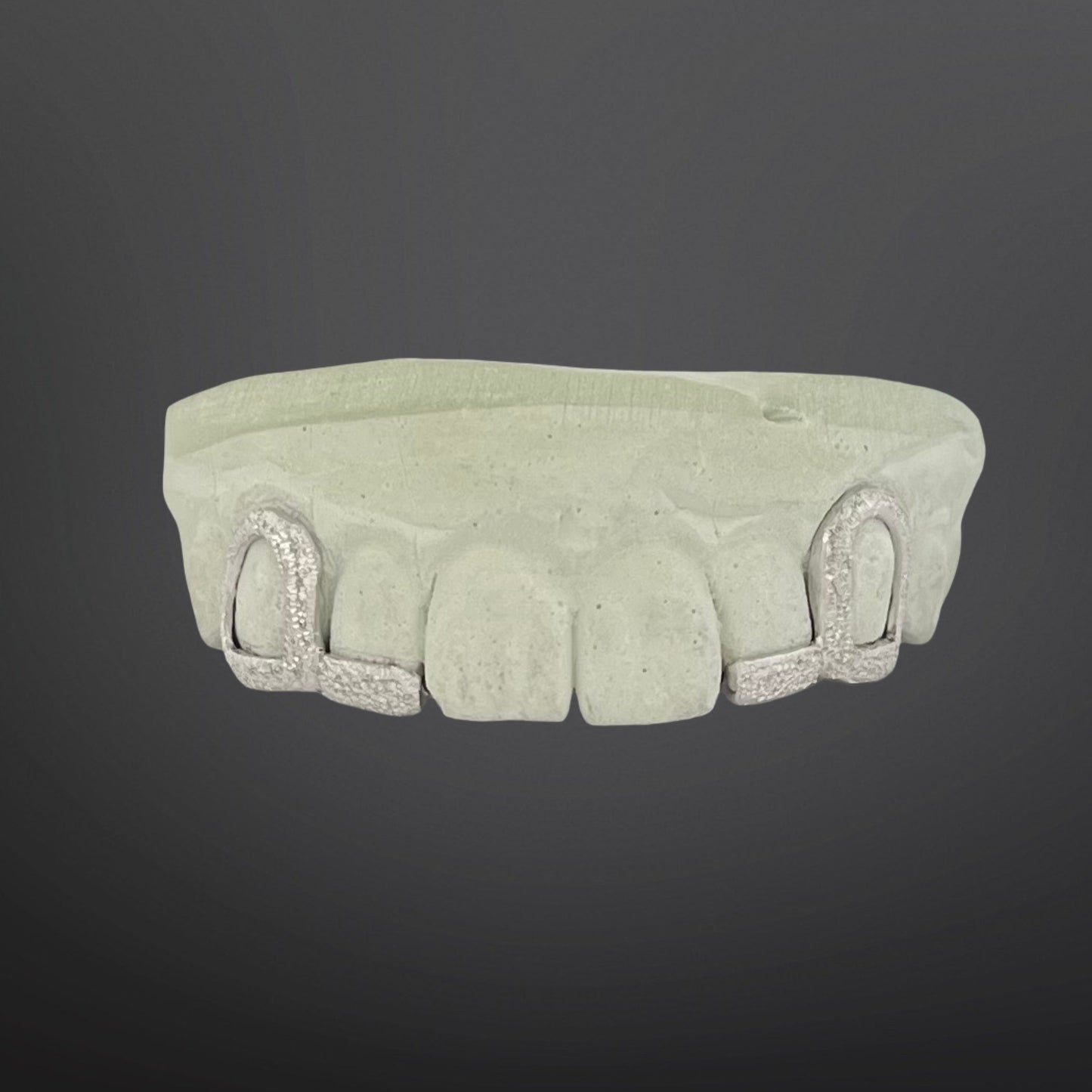 Diamond Dust Open Face And Tip Cover Two By Two Top Set With Back Bar Sterling Silver