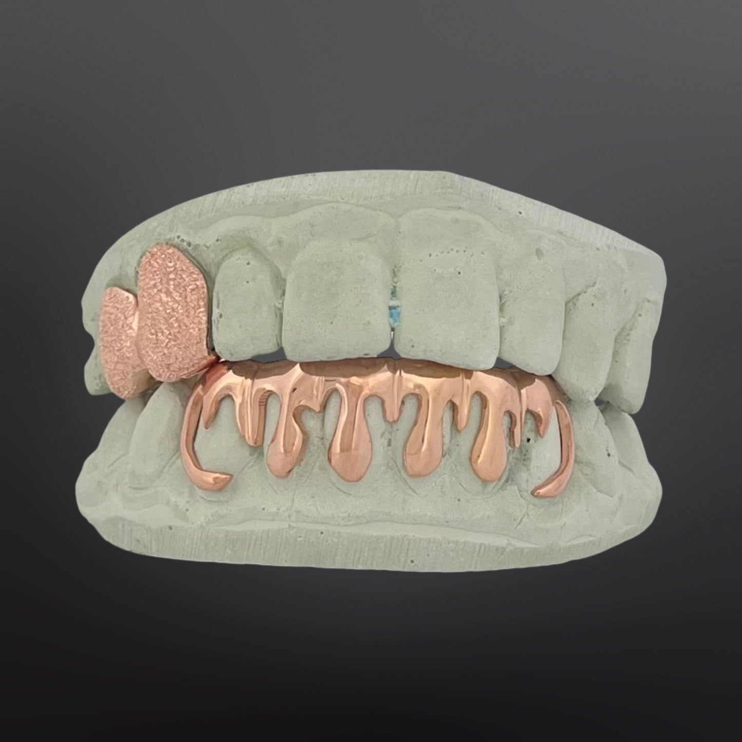 Diamond Dust Two Teeth Top And Drip Design Six Teeth Bottom Full Set Silver Rose