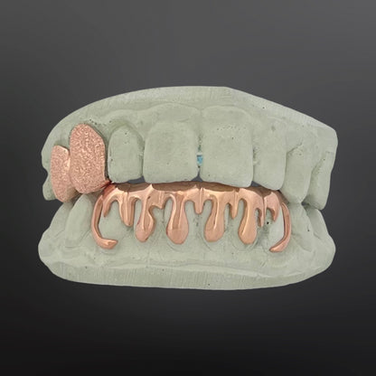 Diamond Dust Two Teeth Top And Drip Design Six Teeth Bottom Full Set Silver Rose