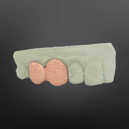 Diamond Dust Two Teeth Top Set Silver Rose