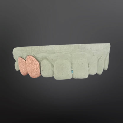 Diamond Dust Two Teeth Top Set Silver Rose