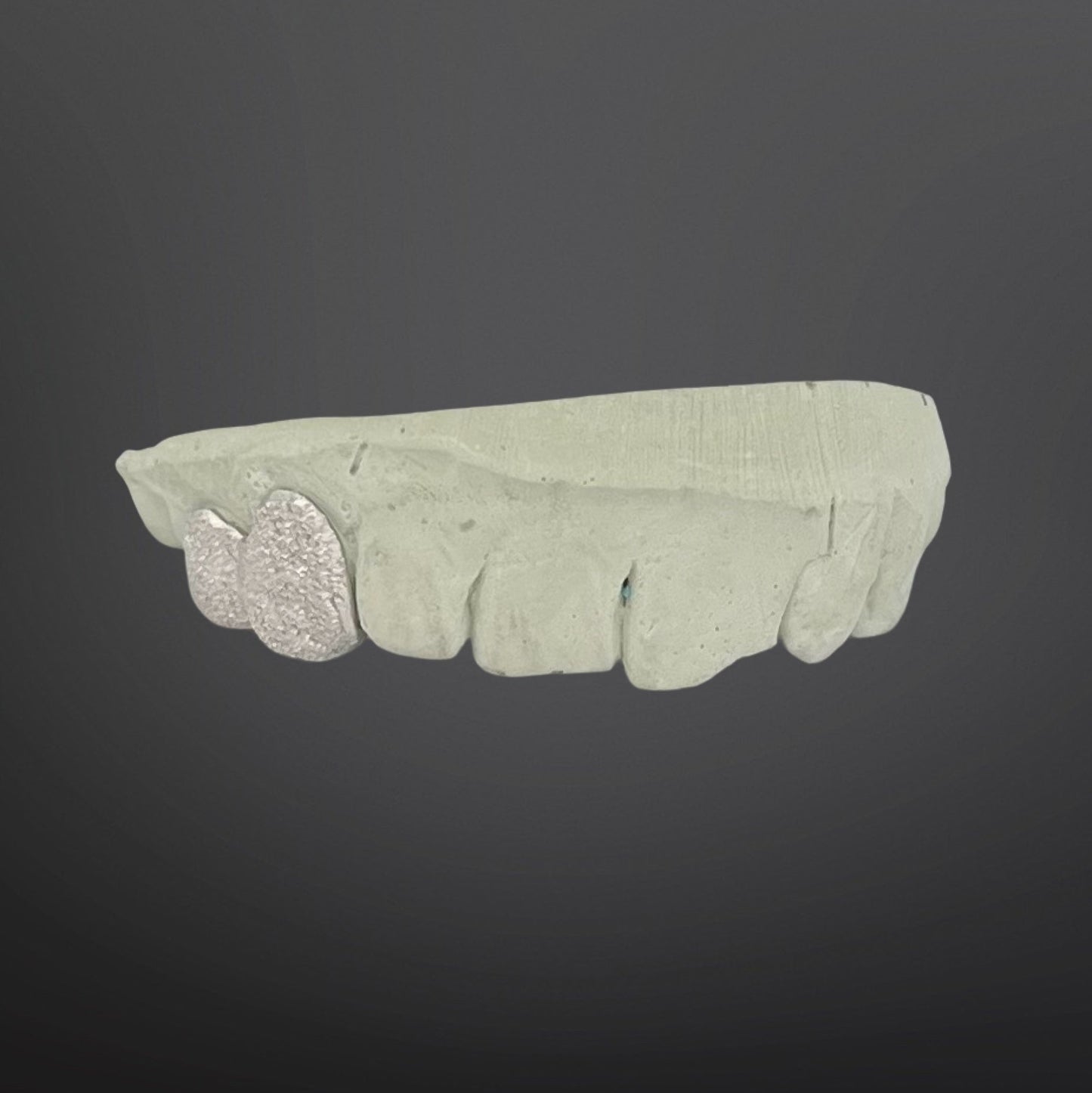 Diamond Dust Top Set Two Teeth Silver White