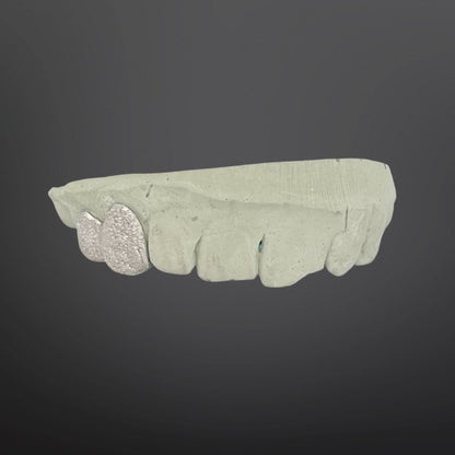 Diamond Dust Top Set Two Teeth Silver White