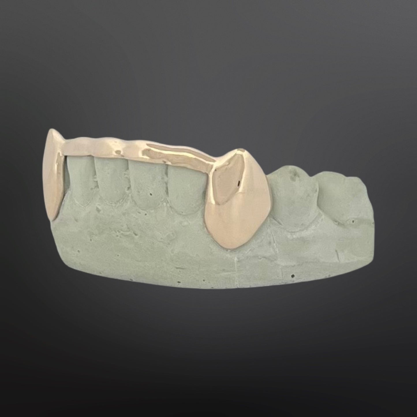 Solid Fangs And Tip Cover Bar Six Teeth Bottom Set Natural Gold