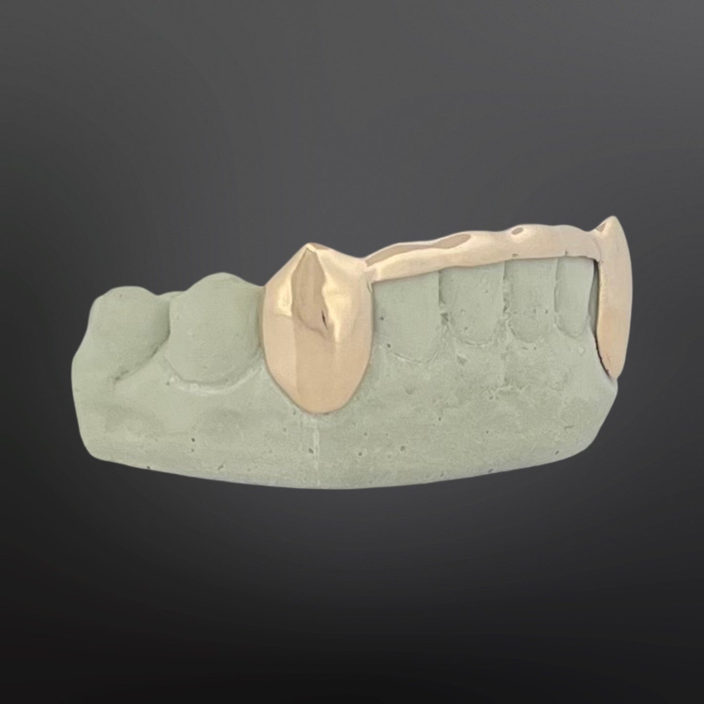 Solid Fangs And Tip Cover Bar Six Teeth Bottom Set Natural Gold