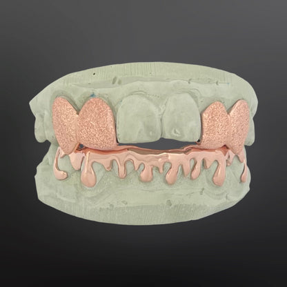 Diamond Dust Four Teeth Top With Back Bar And Drip Design Eight Teeth Bottom Full Set Silver Rose