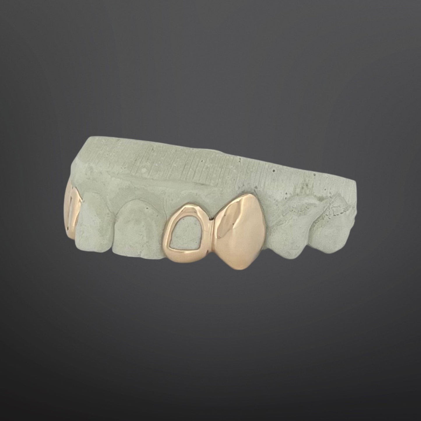 Solid Plain Fangs And Open Face Four Teeth With Back Bar Top Set Natural Gold